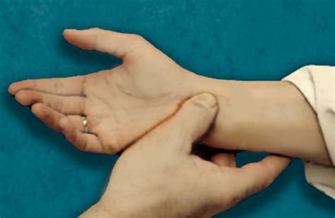 median nerve compression test carpal tunnel|positive durkan's test.